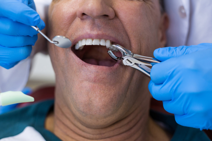 Verzoek om gezonde en goed behandelbare tanden te trekken is geen uitzondering