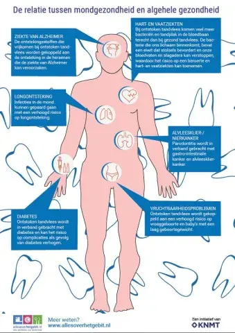 Het verband tussen je mondgezondheid en je algemene gezondheid