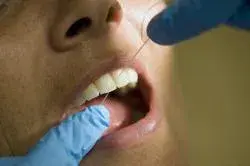 poster flosdraad (tandzijde)