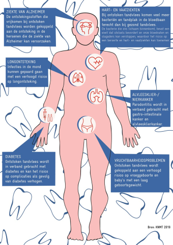 poster Risico's slechte mondzorg onderschat 2