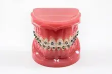 poster tandarts voor orthodontie