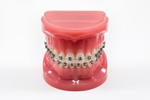 poster tandarts voor orthodontie