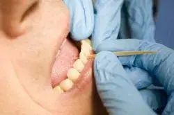 poster tandenstokers