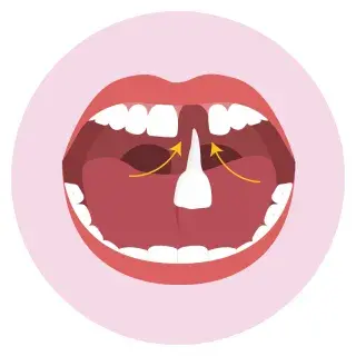 poster tand eruit? tand erin! 3