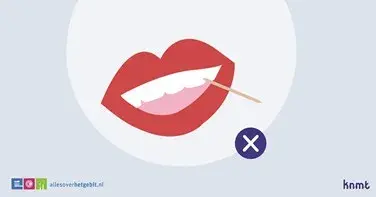 Afbeelding verwijderd.