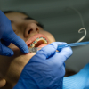 beugelbehandeling bij de orthodontist