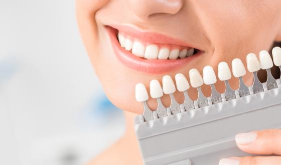 cosmetische mondzorg