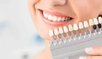 cosmetische mondzorg