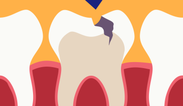 poster 0 tot 18 jaar 18